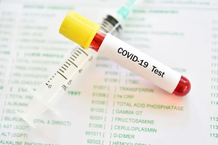 SARS-CoV-2 coronavirus IgM antibodies (qualitative) – laboratory test