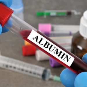 Albumina - badanie laboratoryjne