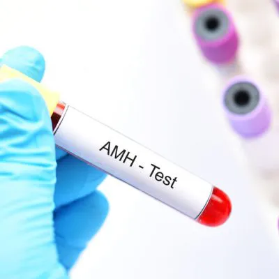 AMH (hormon anty-Mullerowski)