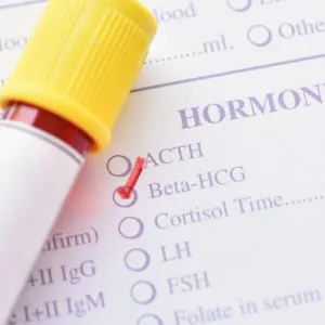 B-HCG (beta HCG) - badanie laboratoryjne