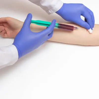 Bilirubina całkowita - badanie laboratoryjne