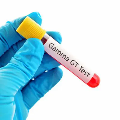 GGTP - badanie laboratoryjne
