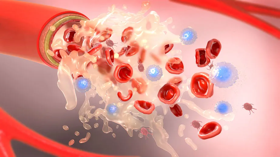 Lipidogram (Profil lipidowy, cholesterol) - badanie laboratoryjne