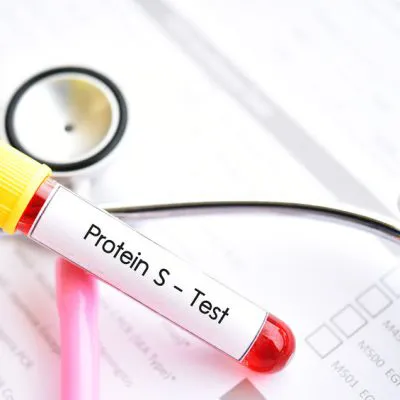 Protein S - laboratory test