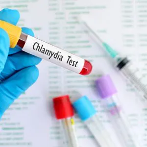 Chlamydia trachomatis IGG