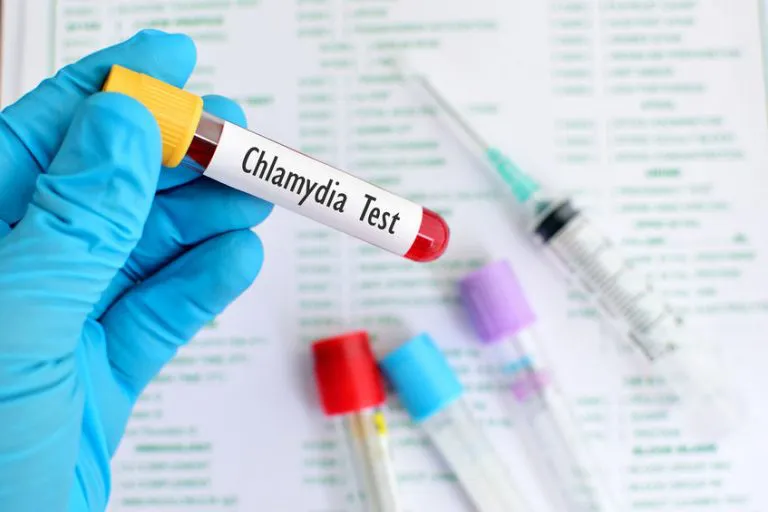 Chlamydia trachomatis IGG – Laboruntersuchung