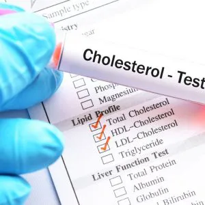 cholesterol-hdl-badanie-laboratoryjne-badamysie HDL-Cholesterin – Laboruntersuchung