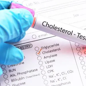 LDL-Cholesterin – Laboruntersuchung