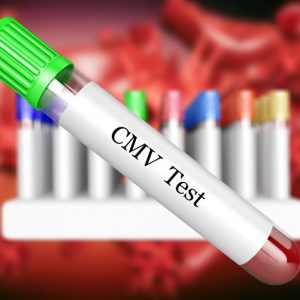 CMV IgG (cytomegalia IgG) - badanie laboratoryjne