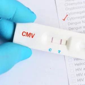 CMV IgM (cytomegalia IgM) - badanie laboratoryjne