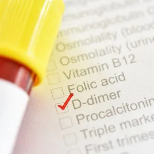 d-dimer-badanie-laboratoryjne-badamysie D-dimer - badanie laboratoryjne