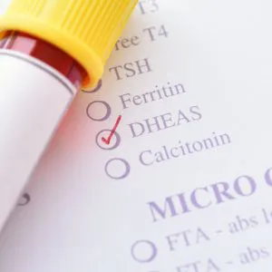 DHEA-S – laboratory test