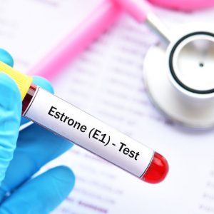 Estradiol - badanie laboratoryjne