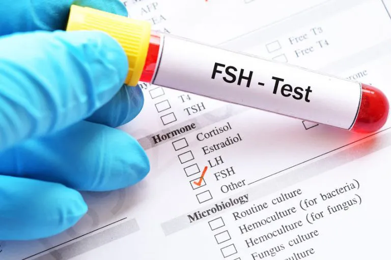FSH – Laboruntersuchung