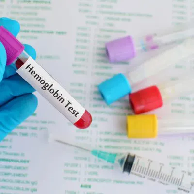 HBA 1c (hemoglobina glikowana)