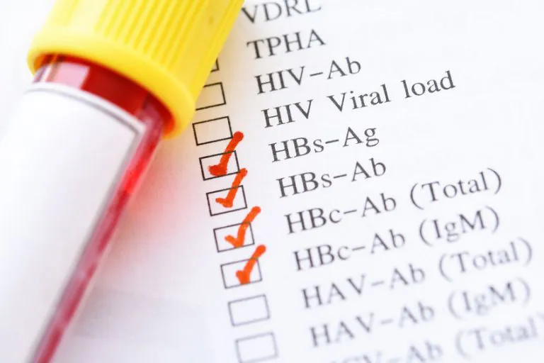 HBsAg (HBS Ag) – laboratory test