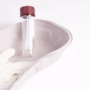 Okkultes Blut im Stuhl – Laboruntersuchung