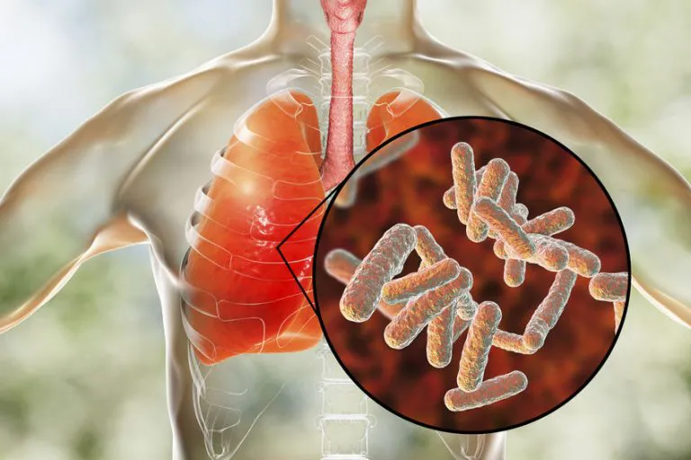 Whooping cough (Bordetella pertussis) IgM antibodies – laboratory test