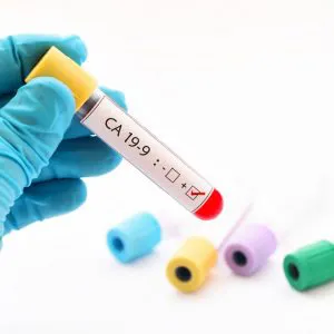 Marker CA19-9