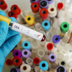 Marker CEA