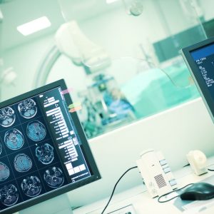 MRI angiografia bez i po kontraście (CM)
