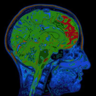 MRI des Kopfes – Gehirn ohne Kontrastmittel (ohne CM)