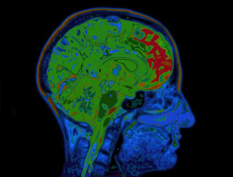 MRI голови – головного мозку без контрасту (без CM)