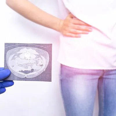 mri-jamy brzusznej bez kontrastu bez cm
