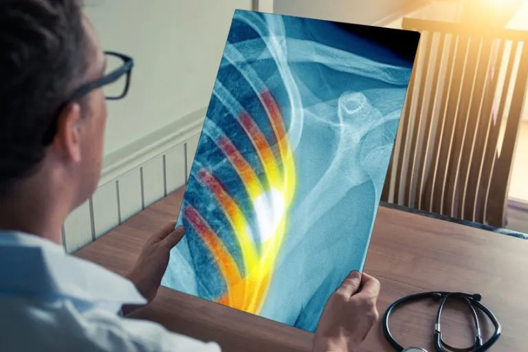 MRI der Knochen nach anatomischen Regionen ohne Kontrastmittel (ohne CM)