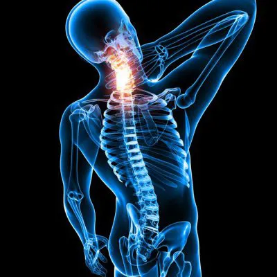 MRI des Halses vor und nach Kontrastmittelgabe (CM)
