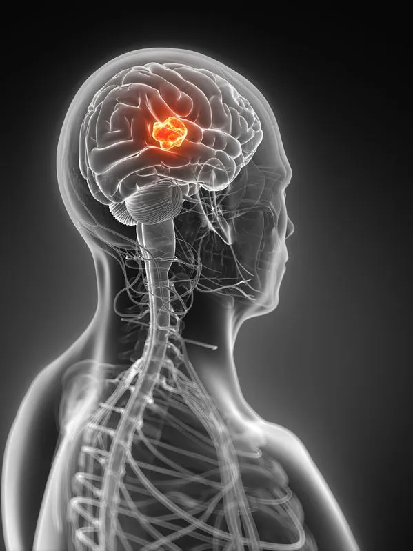 MRI der Hypophyse ohne und mit Kontrastmittel (CM)