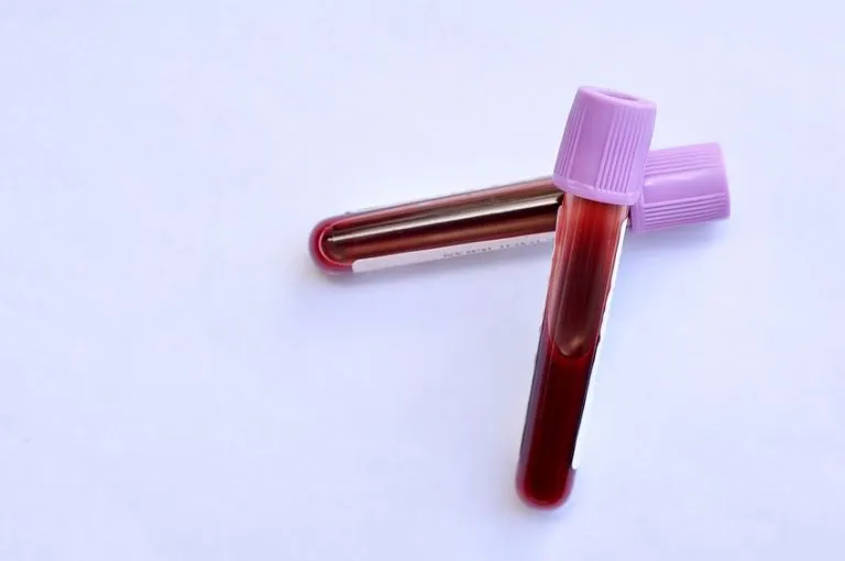 Mumps IGM antibodies (Myxovirus parotitis) – laboratory test
