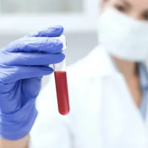 OB - odczyn biernackiego - opad