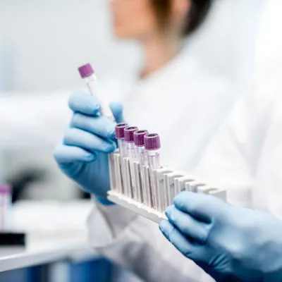 Morfologia krwi z automatycznym rozmazem - badanie laboratoryjne