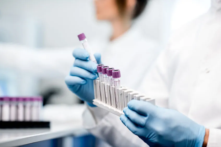 Morfologia krwi z automatycznym rozmazem - badanie laboratoryjne