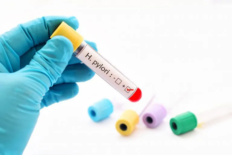Helicobacter pylori IgG antibodies – laboratory test