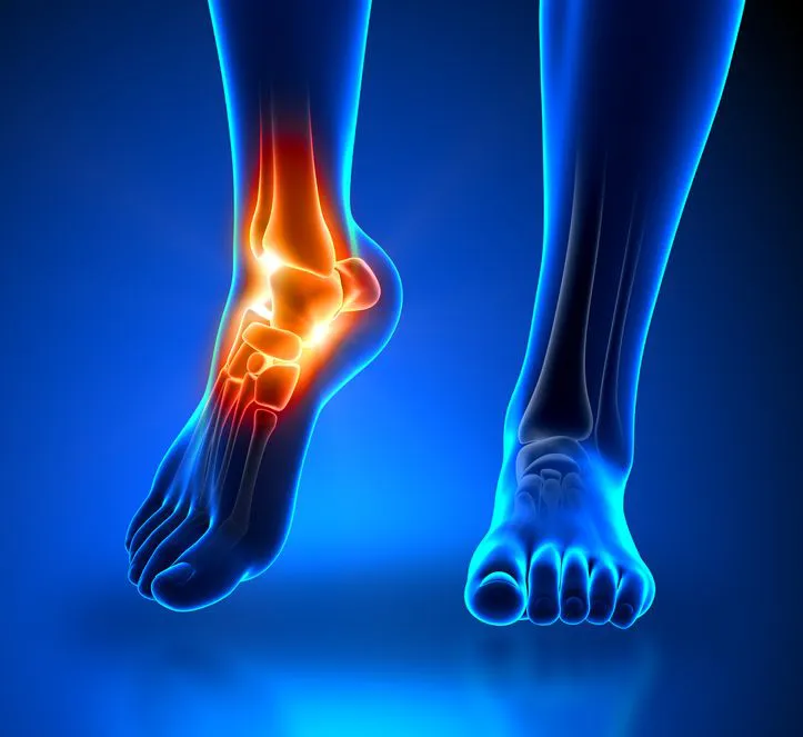 Ankle joint X-ray (AP+lateral)