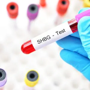 SHBG – laboratory test