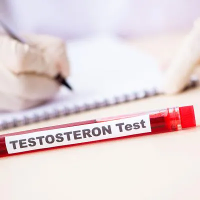 Testosteron - badanie laboratoryjne