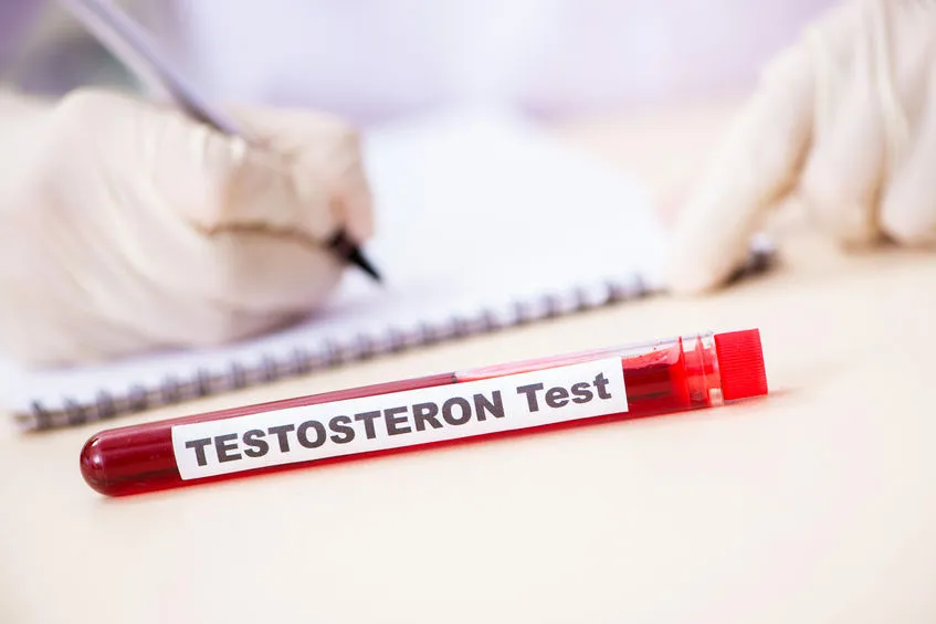 Testosteron - badanie laboratoryjne